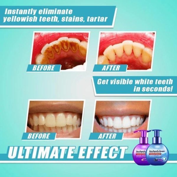 【LAST DAY PROMOTION】 - Intensive Stain Removal Teeth Whitening Toothpaste Online